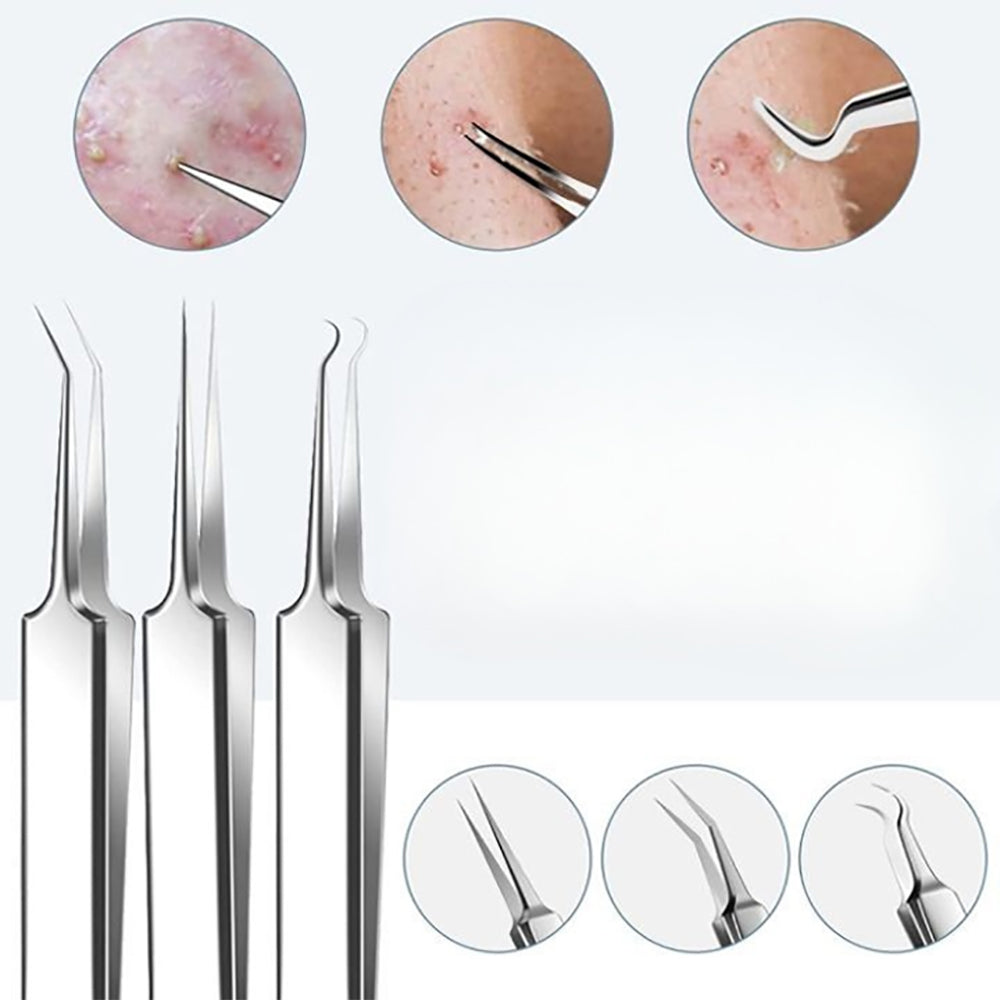 15Pcs  Stainless Steel Blackhead Remover Pimple Popper Tools Kit with Metal Case_5